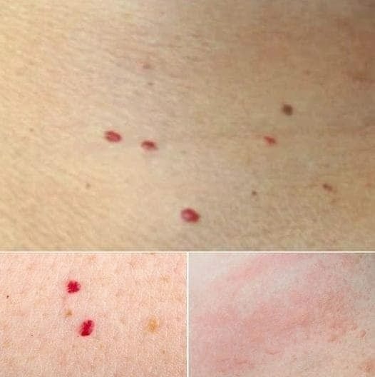 Red Dots On Your Skin