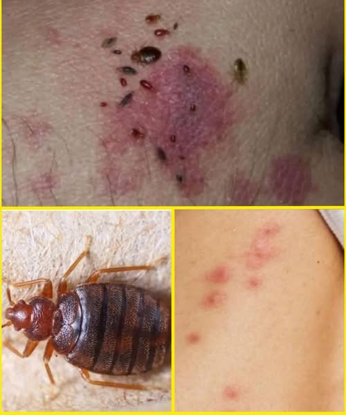 Skin Dots Warning Signs